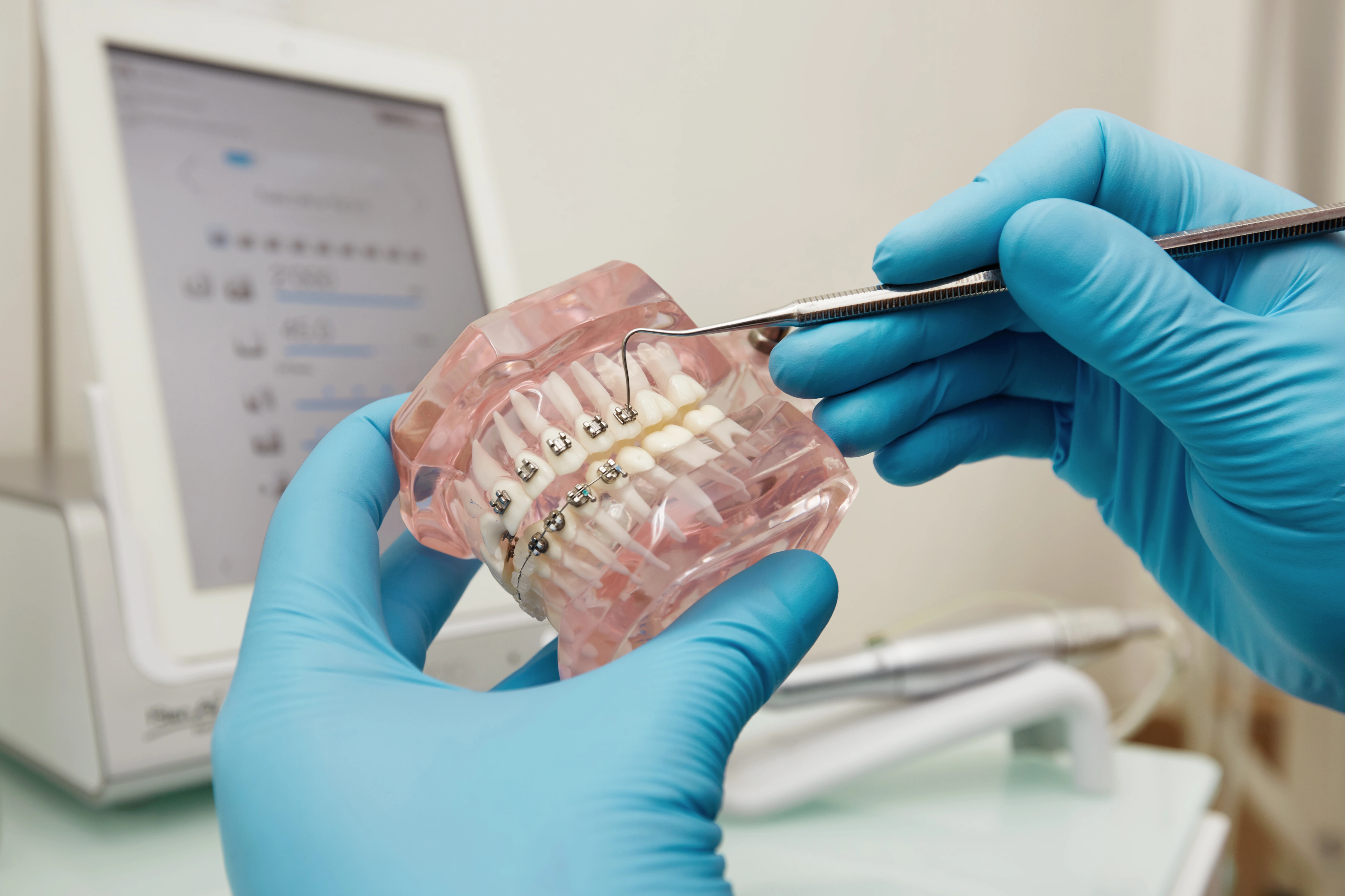 What is Orthodontist